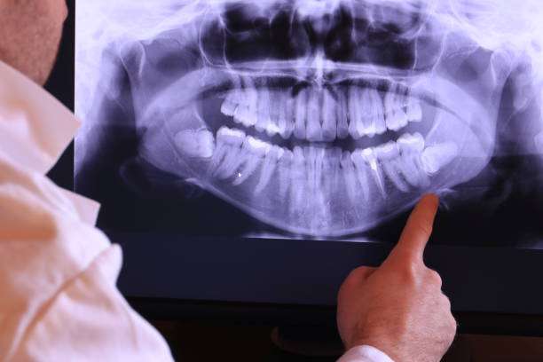 Best Emergency Root Canal Treatment in Stanton, NE